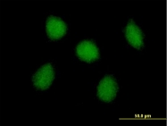 H00084196-B01 - USP48