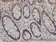 H00084196-M01 - USP48