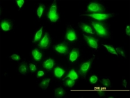 H00084197-M03 - SGK196