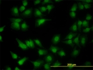 H00084306-M01 - PDCD2L