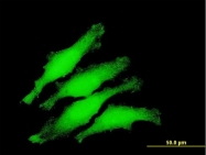 H00084307-B01 - ZNF397