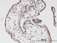 H00084307-M02 - ZNF397