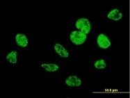 H00084324-B01P - Nuclear protein Hcc-1
