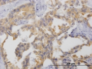 H00084628-M01 - Netrin G2