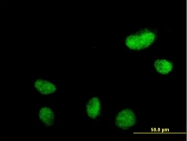 H00084656-B01P - Nuclear protein NP60 / N-PAC