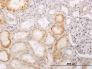 H00084680-M02 - PHACS