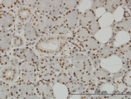 H00084727-M01 - SPSB2 / GRCC9