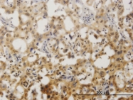 H00084838-M08 - ZNF496