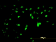 H00084838-M08 - ZNF496