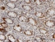 H00084937-M01 - ZNRF1