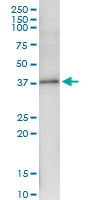 H00085409-D01 - NKD2