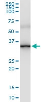 H00089845-D01 - ABCC10 / MRP7