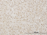 H00089884-M04 - LHX4