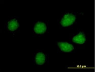 H00090993-B01P - CREB3L1 / OASIS
