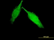 H00091156-M01 - IGFN1