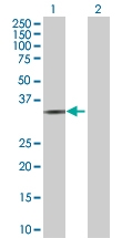 H00091522-B01 - Collagen type XXIII alpha 1 chain