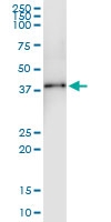 H00091522-D01 - Collagen type XXIII alpha 1 chain