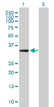 H00091522-D01P - Collagen type XXIII alpha 1 chain