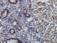 H00093624-M08 - MGC21874