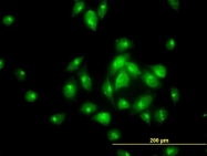 H00093627-M01 - MGC16169