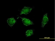 H00093974-B01P - ATPase inhibitor ATPIF1