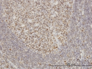 H00094240-M01 - EPSTI1