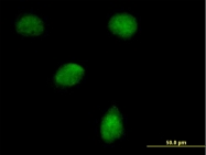 H00112399-B01P - EGLN3 / PHD3