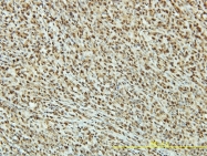H00112858-M01 - TP53RK