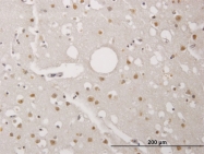 H00112858-M06 - TP53RK