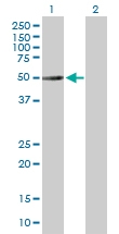 H00113457-B01P - alpha Tubulin / TUBA3C / TUBA2