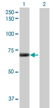 H00113878-B01 - DTX2 / RNF58