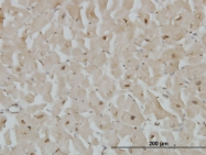 H00114757-M02 - Cytoglobin