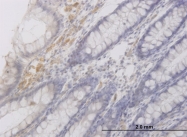 H00115273-M03 - RAB42