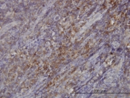 H00115727-M01 - RASGRP4