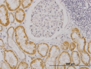 H00115727-M02 - RASGRP4