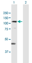 H00115752-B01P - DIS3-like exonuclease 1