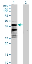 H00118980-B01P - Sideroflexin-2 (SFXN2)