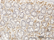 H00124404-B01P - Septin-12 (SEPT12)