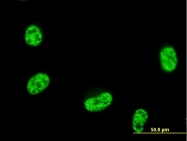 H00124404-B01P - Septin-12 (SEPT12)
