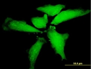 H00126147-B01P - Netrin-5