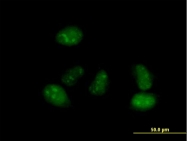 H00130026-B01P - ICA1L
