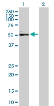 H00130399-B01P - Activin receptor type 1C / ACVR1C