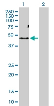 H00130399-D01P - Activin receptor type 1C / ACVR1C