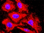 H00130399-M01 - Activin receptor type 1C / ACVR1C