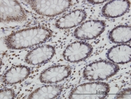 H00130497-M04 - OSR1 / ODD