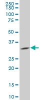 H00132160-A01 - Protein phosphatase 1M / PPM1M