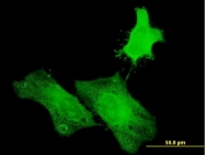 H00132243-B01P - Histone H1oo / H1FOO