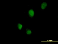 H00140432-B01P - RNF113B