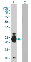H00140459-B01 - ASB6