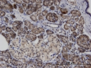H00140461-M05 - ASB8